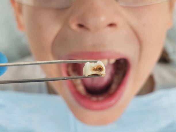 Best Emergency TMJ Treatment in Woodbine, GA